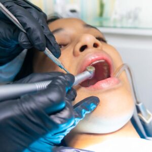 4 Qualities of the Best Dental Care 5